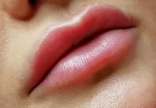 Semi-Permanent Lip Blush