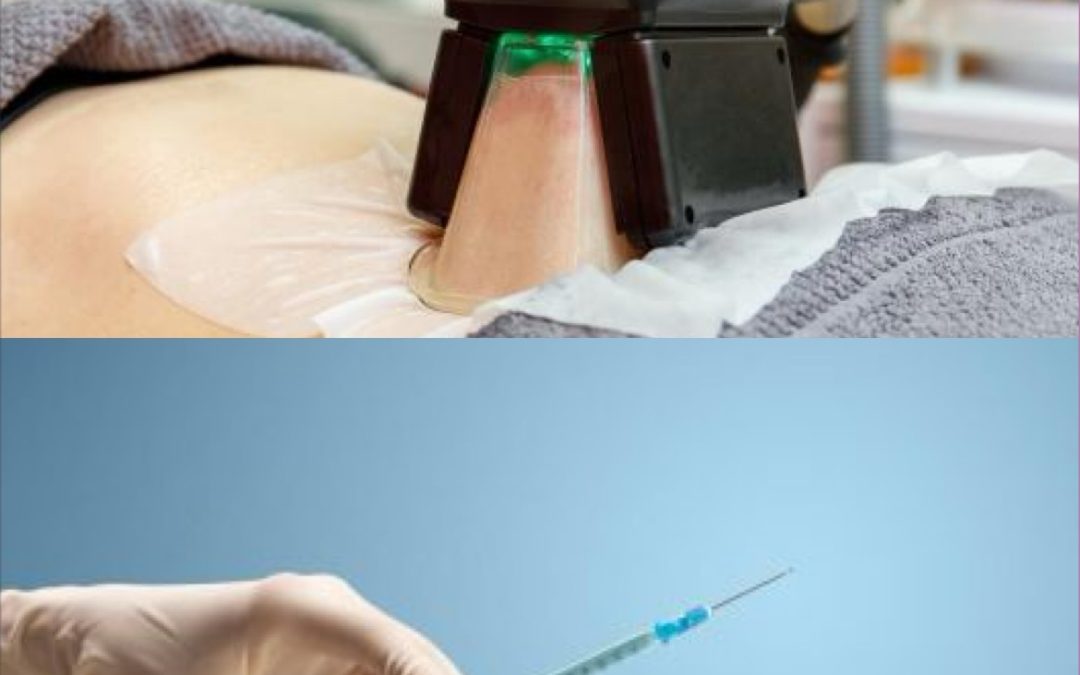 Fat Freezing vs Fat Dissolving Injections